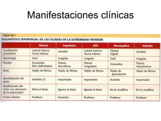 Manifestaciones clínicas 