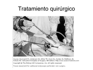 Tratamiento quirúrgico 