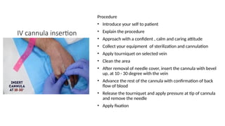 IV cannula insertion
Procedure
• Introduce your self to patient
• Explain the procedure
• Approach with a confident , calm and caring attitude
• Collect your equipment of sterilization and cannulation
• Apply tourniquet on selected vein
• Clean the area
• After removal of needle cover, insert the cannula with bevel
up, at 10 - 30 degree with the vein
• Advance the rest of the cannula with confirmation of back
flow of blood
• Release the tourniquet and apply pressure at tip of cannula
and remove the needle
• Apply fixation
 