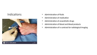 Indications • Administration of fluids
• Administration of medication
• Administration of anaesthetic drugs
• Administration of blood and blood products
• Administration of iv contrast for radiological imaging
 