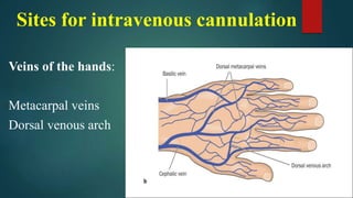 IV cannulajgfftion.pdf