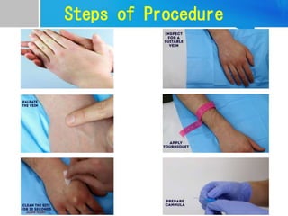 Steps of Procedure
 