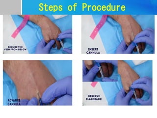 Steps of Procedure
 