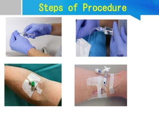 Steps of Procedure
 