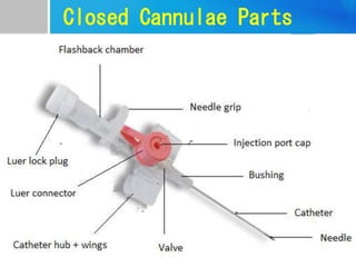 Closed Cannulae Parts
 