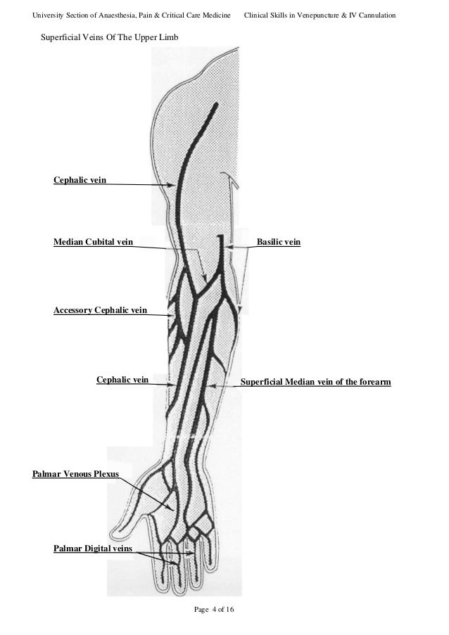 Iv cannulation sites