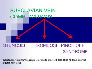 SUBCLAVIAN VEIN
COMPLICATIONS
STENOSIS THROMBOSI PINCH OFF
SYNDROME
Subclavian vein (SCV) access is prone to more complications than internal
jugular vein (IJV)
 