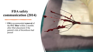 FDA safety
communication (2014)
• FDA recommended removal of
the IVC filter within 2 months
after filter placement if the
patient's risk of thrombosis had
passed
 