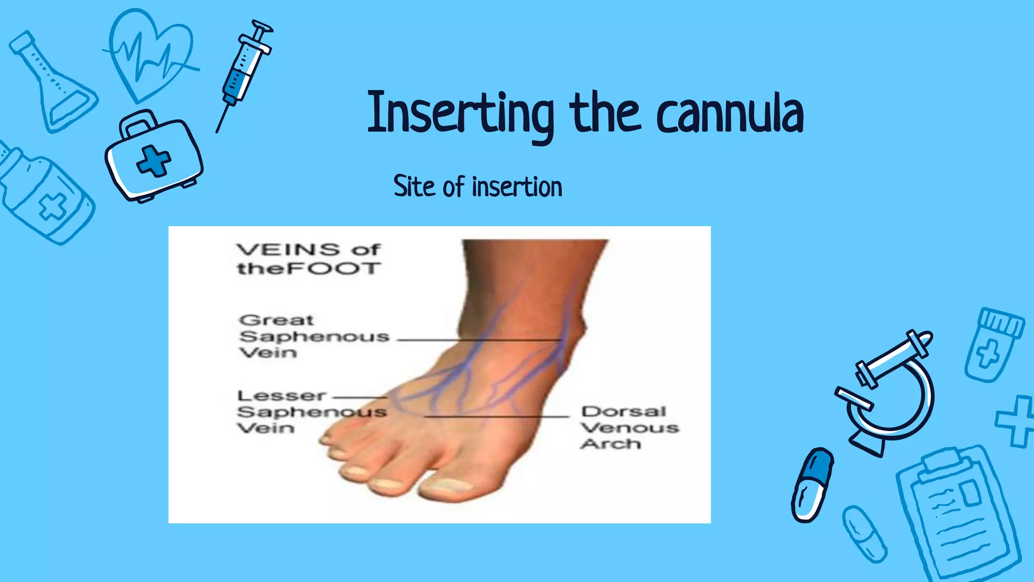 Site of insertion
Inserting the cannula
 
