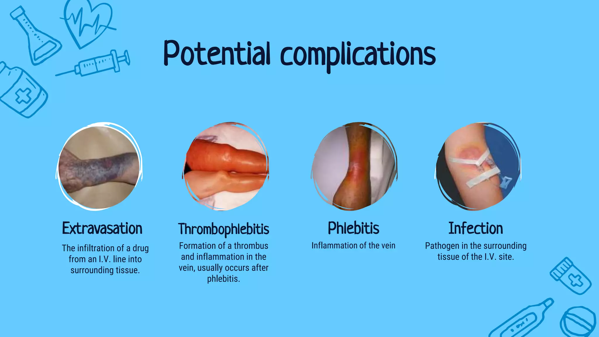 Potential complications
The infiltration of a drug
from an I.V. line into
surrounding tissue.
Extravasation
Pathogen in the surrounding
tissue of the I.V. site.
Infection
Formation of a thrombus
and inflammation in the
vein, usually occurs after
phlebitis.
Thrombophlebitis
Inflammation of the vein
Phlebitis
 