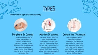 TYPES
The most commonly used IV
cannula, the peripheral IV
cannula is usually used for
emergency room and surgical
patients, or for those individuals
who undergo radiological
imaging. Each of these IV lines is
used for up to three days and
not beyond that.
Peripheral IV Cannula
used for patients who are
undergoing prolonged
treatments. They are also a
good choice for transferring
large amounts of blood or any
other fluid into the patient’s
body. This IV cannula is inserted
into the jugular vein, subclavian
vein or the femoral vein.
Central line IV cannulas
This is the perfect choice for
those patients who are
undergoing a treatment that
lasts for more than five days
but less than a month. They are
considered a less invasive
method. The IV line is placed on
a large vein in the upper part of
the patients arm.
Mid-line IV cannula.
There are 3 main types of IV cannulas, namely:
 