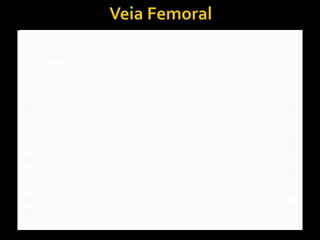 Veia Femoral