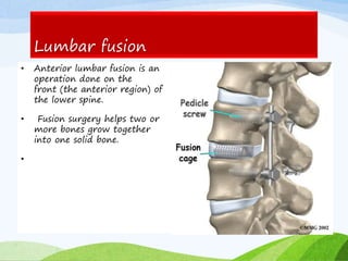 Lumbar fusion
• Anterior lumbar fusion is an
operation done on the
front (the anterior region) of
the lower spine.
• Fusion surgery helps two or
more bones grow together
into one solid bone.
•
 