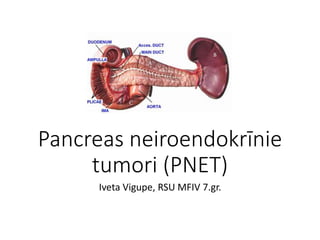 Pancreas neiroendokrīnie
tumori (PNET)
Iveta Vigupe, RSU MFIV 7.gr.
 