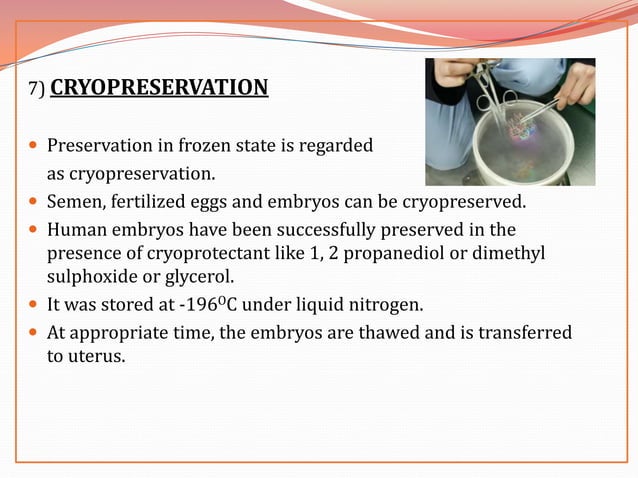 In Vitro Fertilization PPT