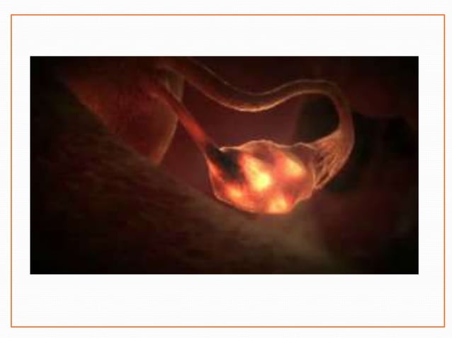 In Vitro Fertilization PPT
