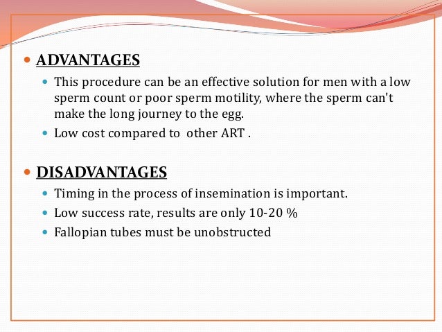 In Vitro Fertilization