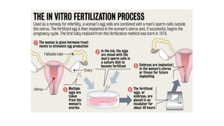 IN VITRO FERTILISATION IVF IVF.PDF INVITRO | PDF