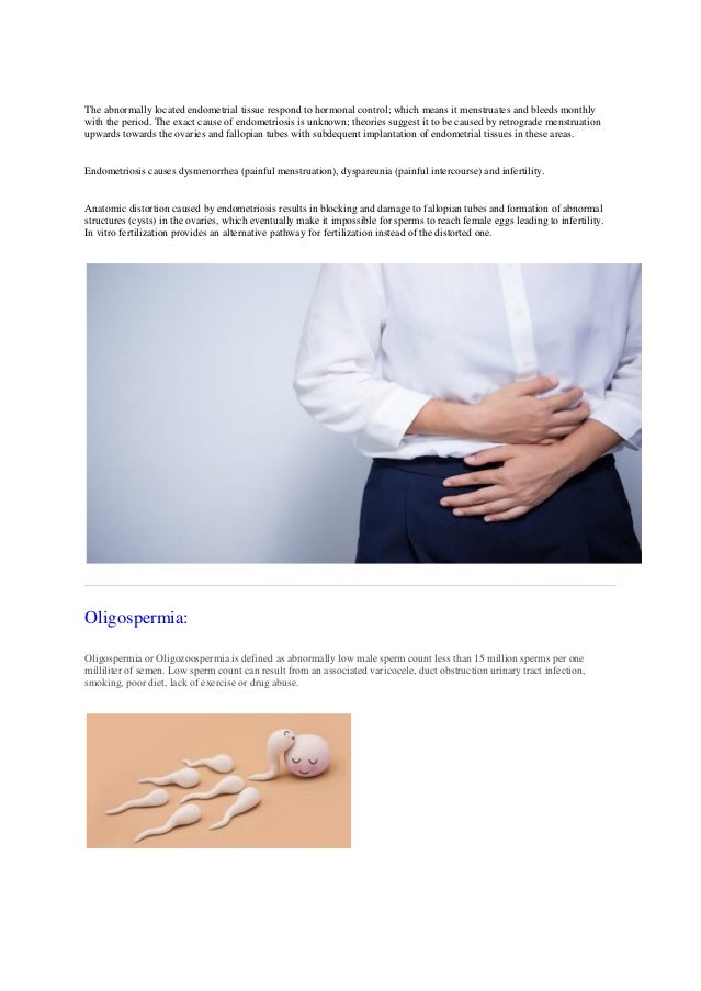 Ivf all about_the_miracle_test_tube_baby_procedure