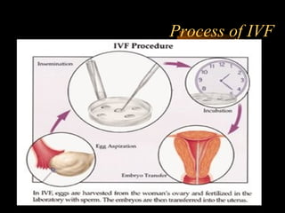 Engineering 124; 
Spring 2003 
Process of IVF 
2 
 