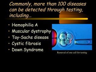Commonly, more than 100 diseases 
can be detected through testing, 
including… 
• Hemophilia A 
• Muscular dystrophy 
• Tay-Sachs disease 
• Cystic fibrosis 
• Down Syndrome 
Engineering 124; 
Spring 2003 
Removal of one cell for testing 
4 
 