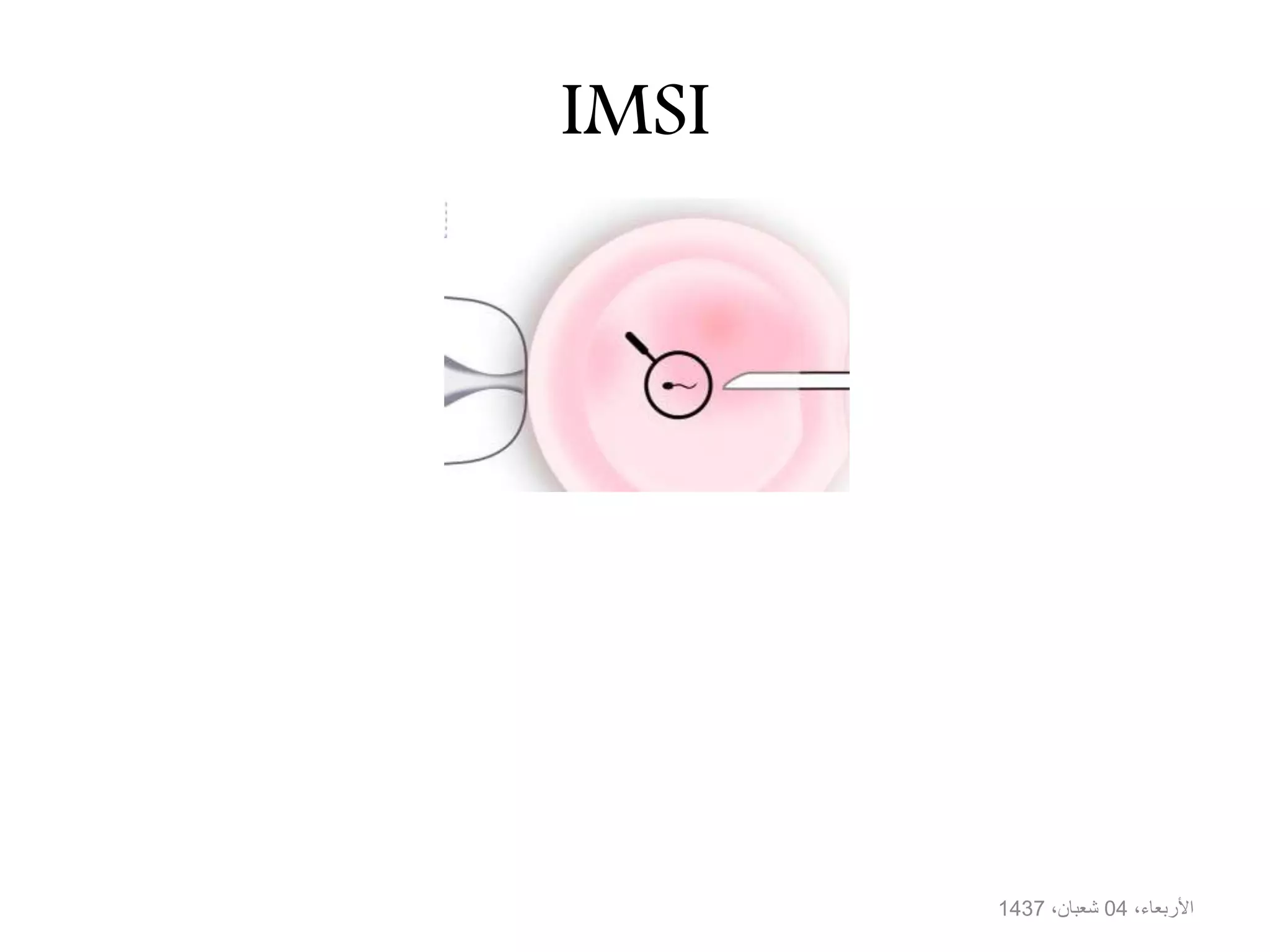 IMSI
،األربعاء04،شعبان1437