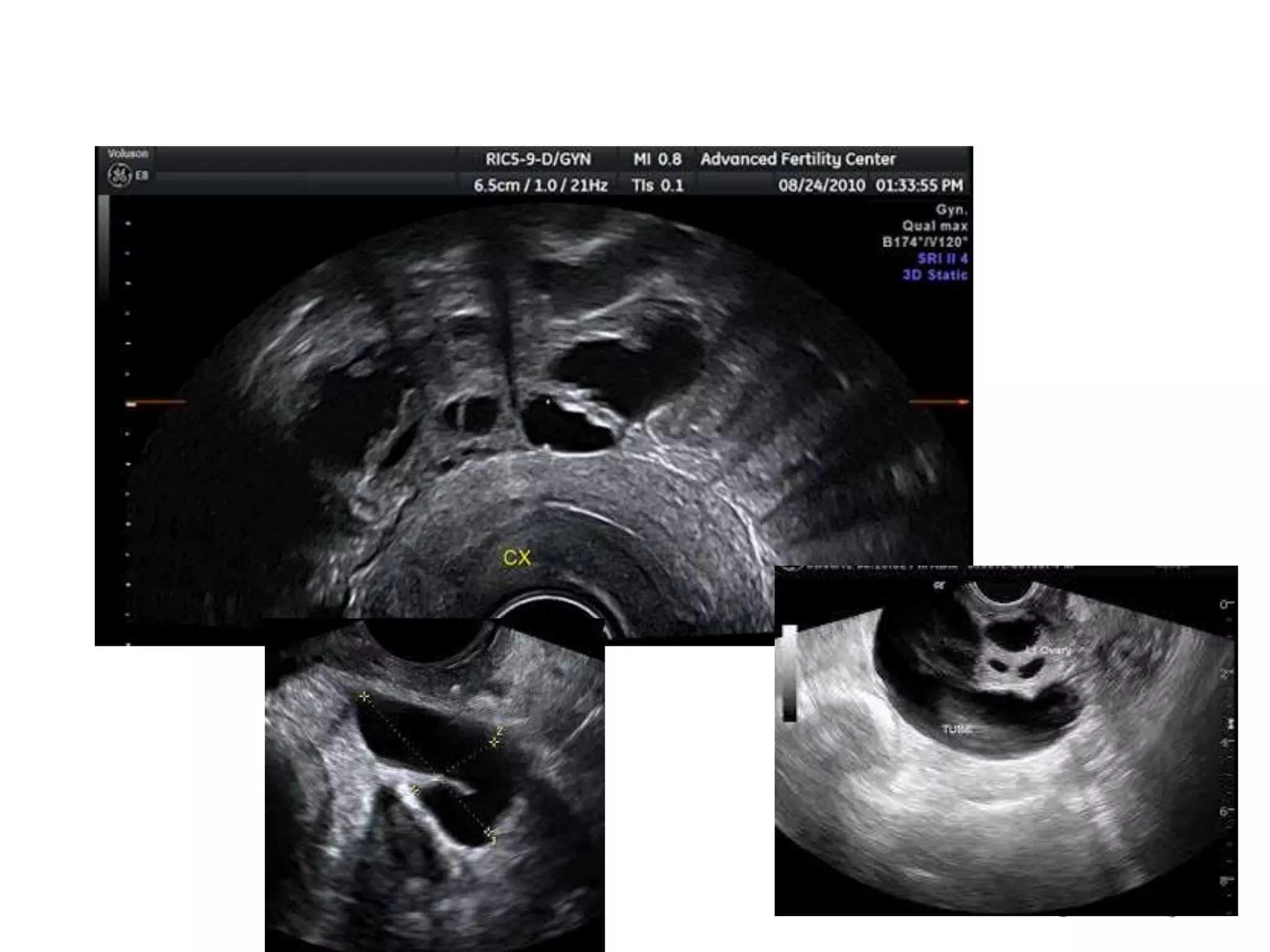 ،األربعاء04،شعبان1437