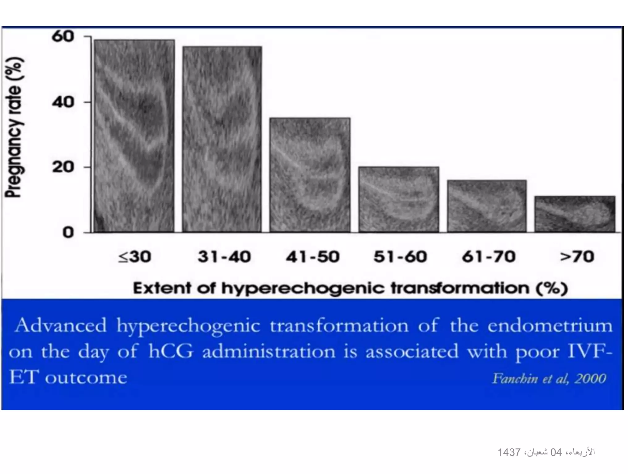 ،األربعاء04،شعبان1437