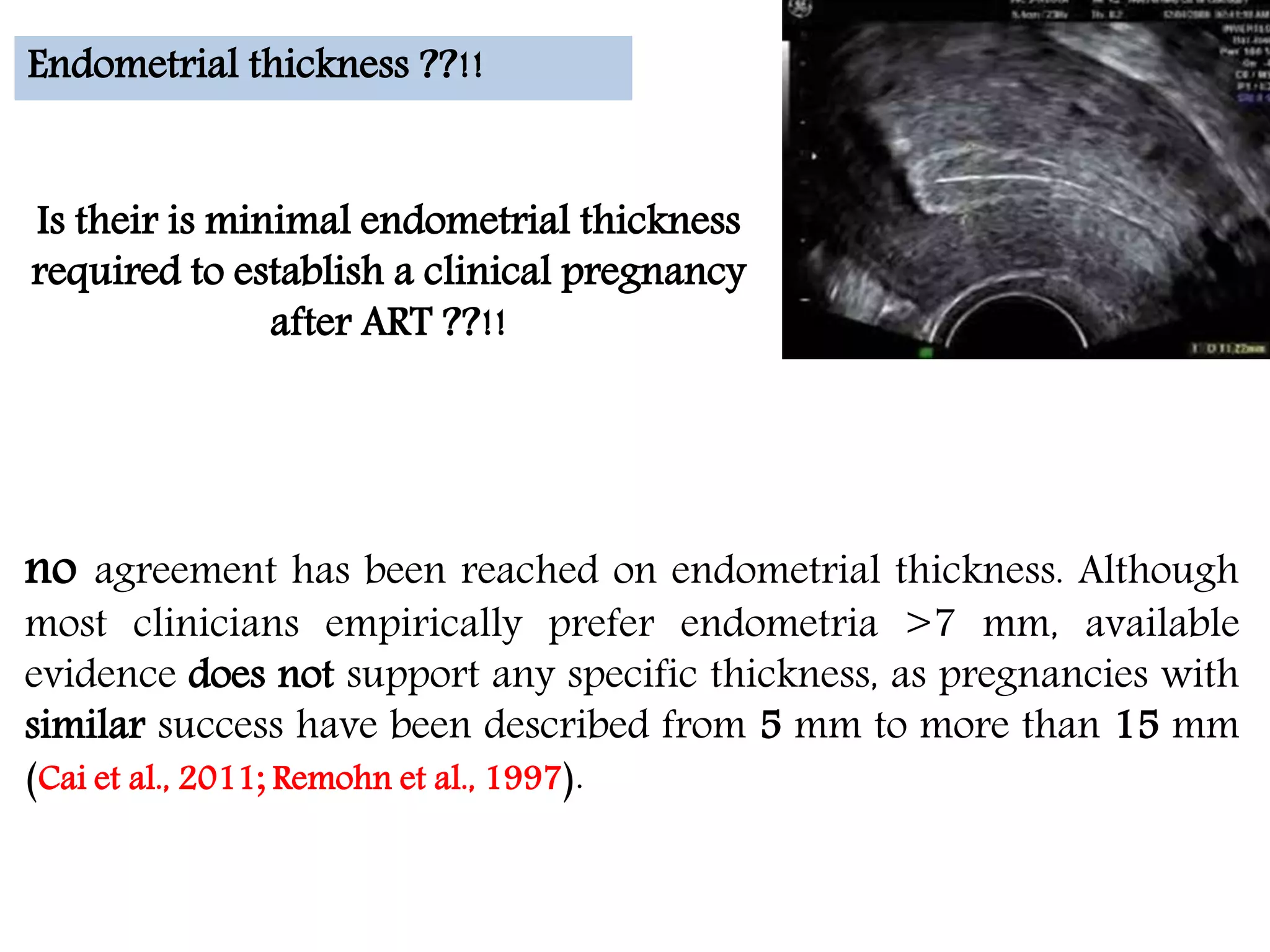 no agreement has been reached on endometrial thickness. Although
most clinicians empirically prefer endometria >7 mm, available
evidence does not support any specific thickness, as pregnancies with
similar success have been described from 5 mm to more than 15 mm
(Cai et al., 2011; Remohn et al., 1997).
Endometrial thickness ??!!
Is their is minimal endometrial thickness
required to establish a clinical pregnancy
after ART ??!!