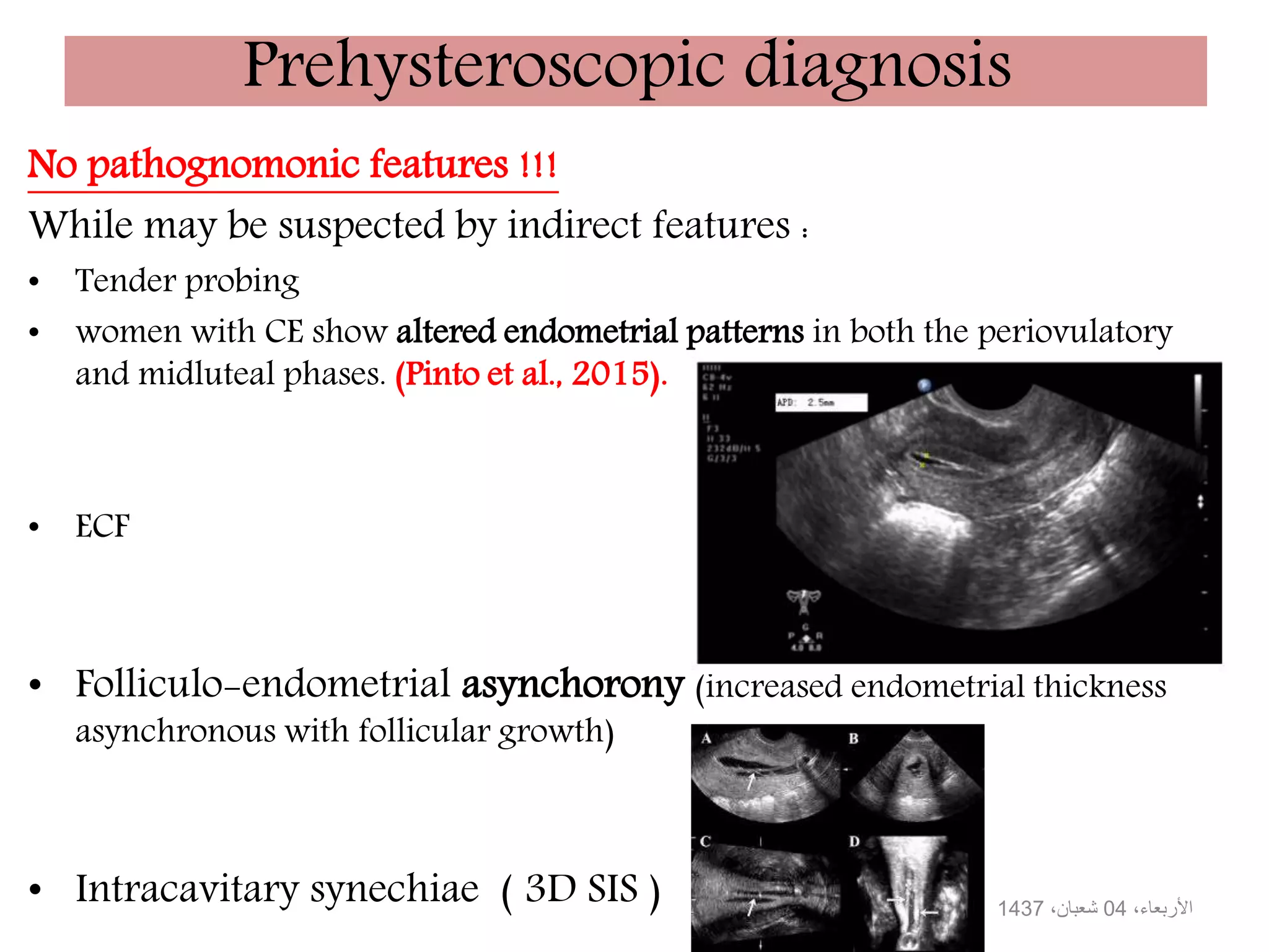 Prehysteroscopic diagnosis
No pathognomonic features !!!
While may be suspected by indirect features :
• Tender probing
• women with CE show altered endometrial patterns in both the periovulatory
and midluteal phases. (Pinto et al., 2015).
• ECF
• Folliculo-endometrial asynchorony (increased endometrial thickness
asynchronous with follicular growth)
• Intracavitary synechiae ( 3D SIS ) ،األربعاء04،شعبان1437