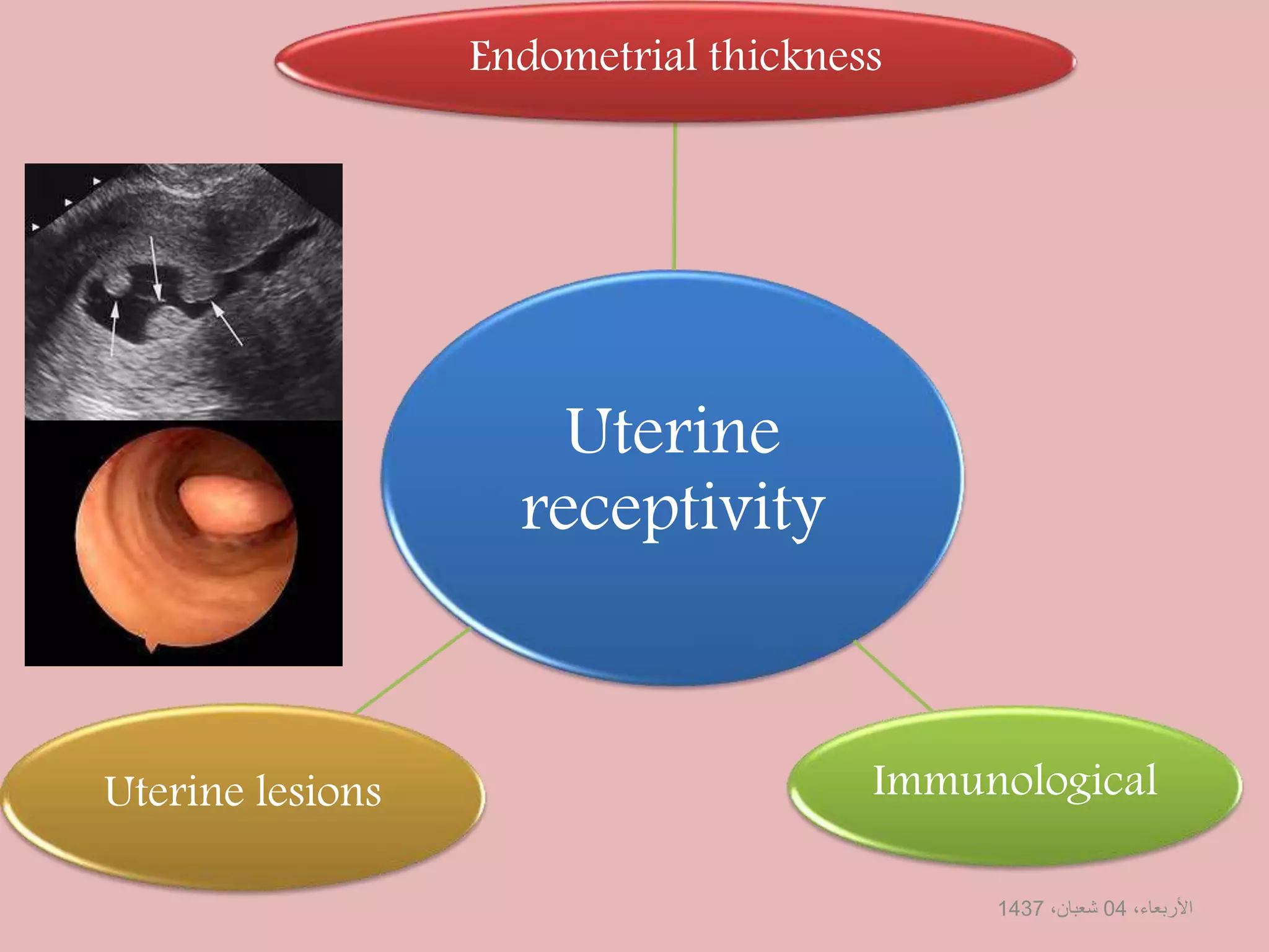 Uterine
receptivity
Endometrial thickness
Uterine lesions Immunological
،األربعاء04،شعبان1437