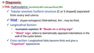  Diagnosis:
TVS: Hydrosalpinx: Sensitivity 84% and specificity 99%
 Tubular anechoic fusiform structure (C or S shaped) separated
from ovary and uterus
 Wall : (hyper-echogenic) Well-defined, thin ; may be thick.
 Longitudinal Section:
• Incomplete septation  “Beads on a string sign"
• “Waist” sign: refers to diametrically opposed indentations in the
wall of the cystic lesion.
 Cross section: Longitudinal folds become thick and give a
“Cogwheel” appearance
 