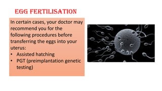 Egg fertilisation
In certain cases, your doctor may
recommend you for the
following procedures before
transferring the eggs into your
uterus:
• Assisted hatching
• PGT (preimplantation genetic
testing)
 