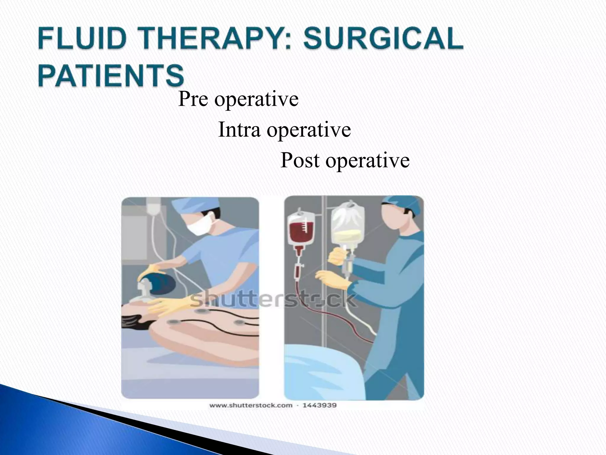 Pre operative
Intra operative
Post operative
 