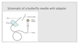 Schematic of a butterfly needle with adapter
 