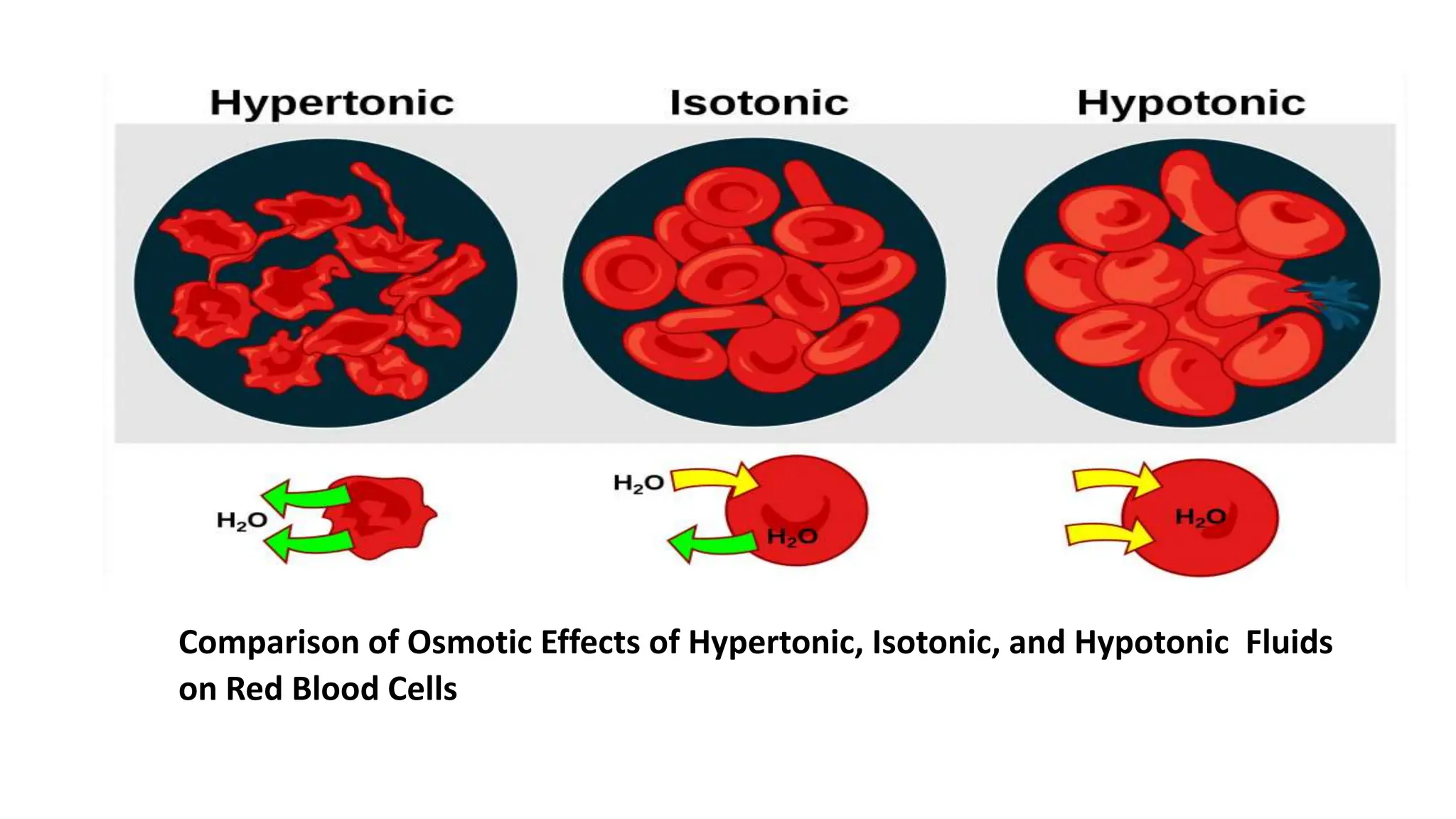 Comparison of Osmotic Effects of Hypertonic, Isotonic, and Hypotonic Fluids
on Red Blood Cells
 