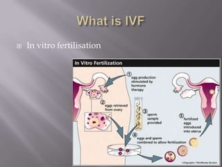  In vitro fertilisation
 