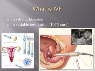 In vitro fertilisation
 In variable fertilisation (100% sure)
 