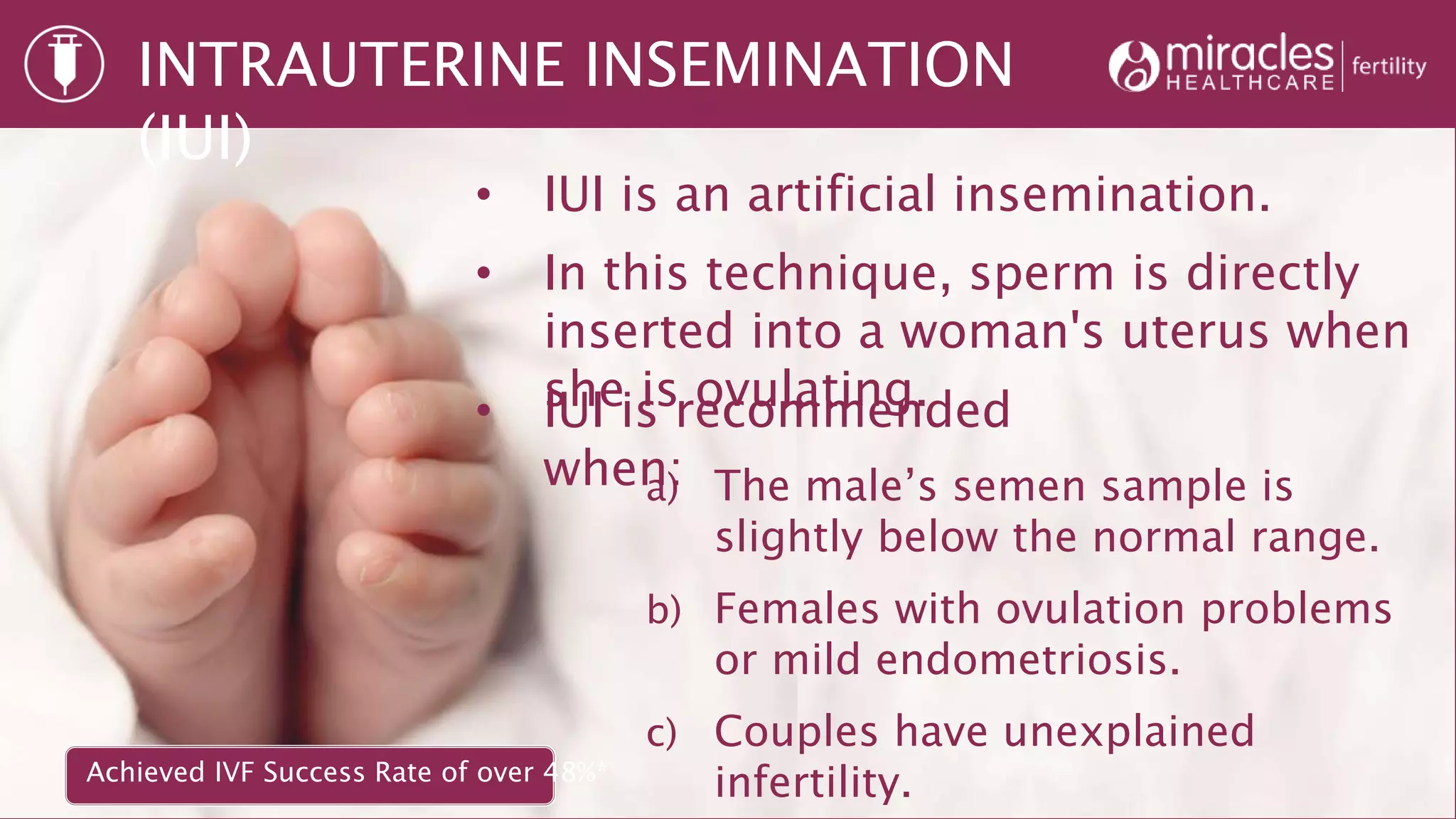 INTRAUTERINE INSEMINATION
(IUI)
• IUI is an artificial insemination.
• In this technique, sperm is directly
inserted into a woman's uterus when
she is ovulating.• IUI is recommended
when:a) The male’s semen sample is
slightly below the normal range.
b) Females with ovulation problems
or mild endometriosis.
c) Couples have unexplained
infertility.Achieved IVF Success Rate of over 48%*
 