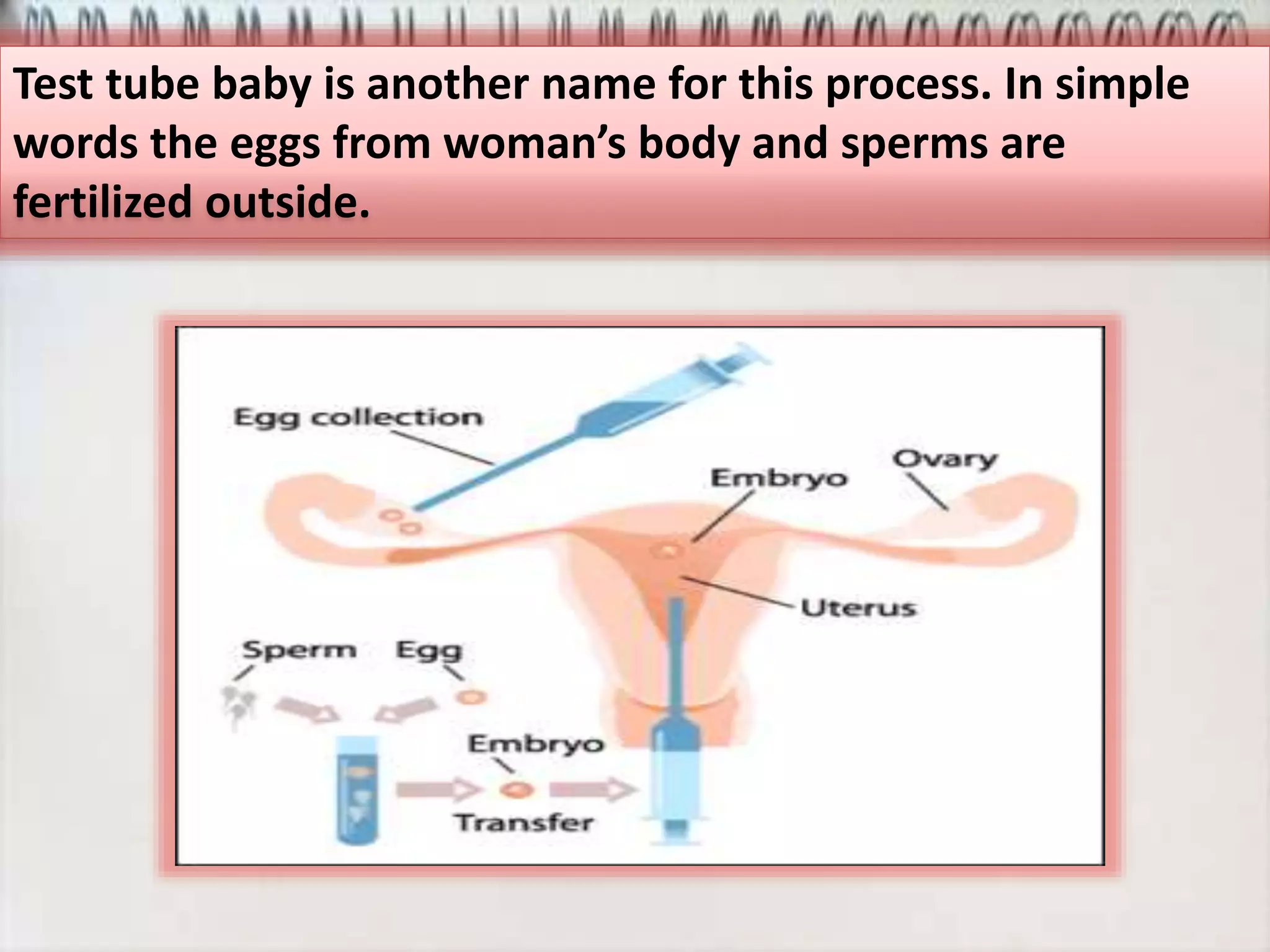 Test tube baby is another name for this process. In simple
words the eggs from woman’s body and sperms are
fertilized outside.
 