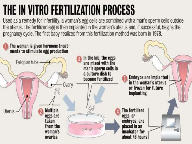 Ivf procedure