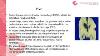 IVH and Head Scan Protocols in preterm babies | PPTX