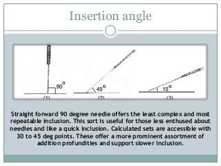 Insertion angle
Straight forward 90 degree needle offers the least complex and most
repeatable inclusion. This sort is useful for those less enthused about
needles and like a quick inclusion. Calculated sets are accessible with
30 to 45 deg points. These offer a more prominent assortment of
addition profundities and support slower inclusion.
 