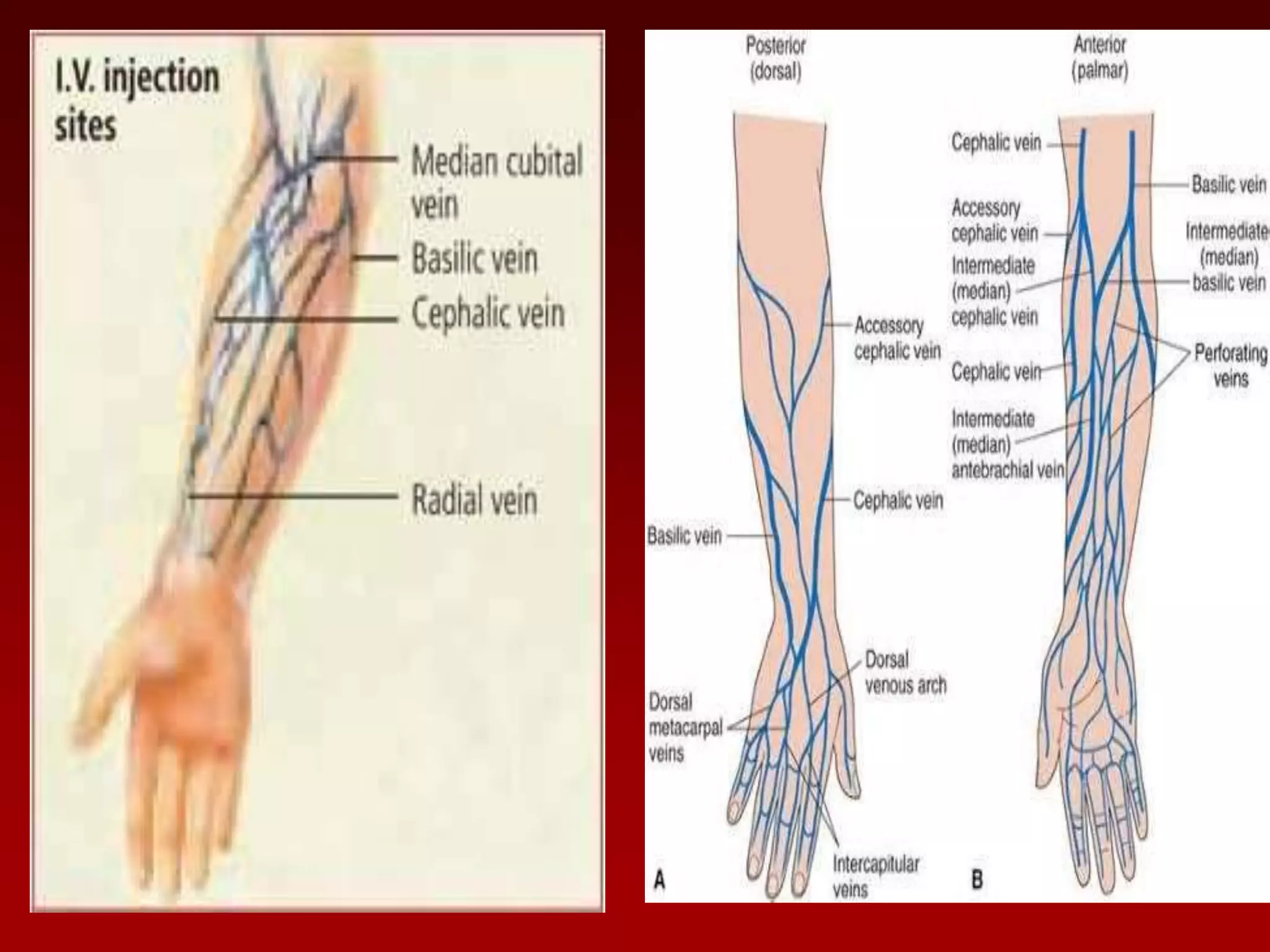 Iv injection- intravenous injection | PPTX