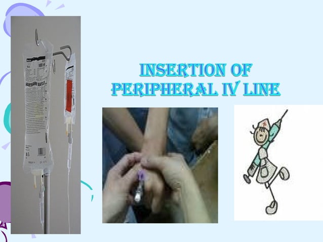 Iv Insertion Steps Iv insertion | PPT