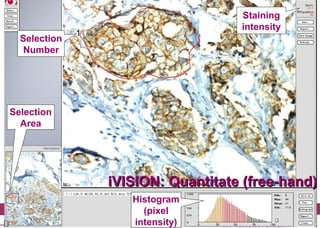 iVision, an automated imaging system for IHC and ISH on Tissue ...
