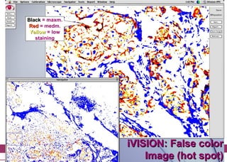 iVision, an automated imaging system for IHC and ISH on Tissue ...