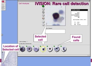 iVision, an automated imaging system for IHC and ISH on Tissue ...