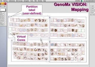 iVision, an automated imaging system for IHC and ISH on Tissue ...