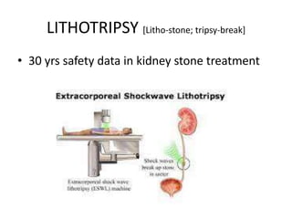 LITHOTRIPSY [Litho-stone; tripsy-break]
• 30 yrs safety data in kidney stone treatment
 